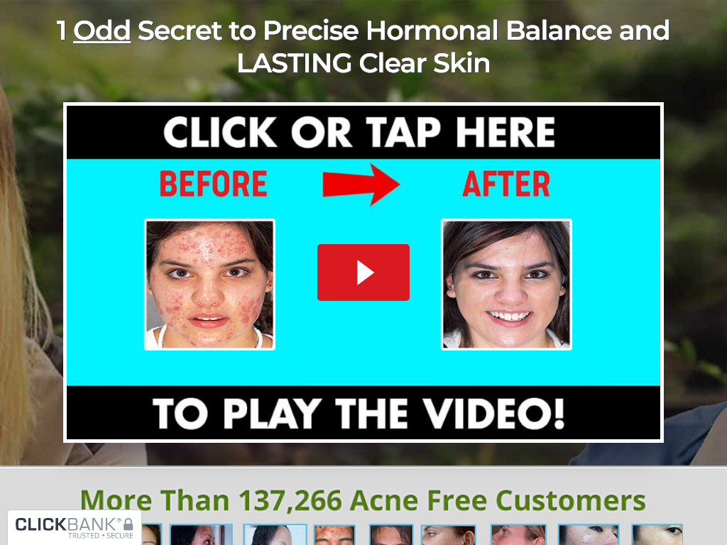 ACNE NO MORE REVIEW – I AM FURIOUS I WAITED 6 MONTHS