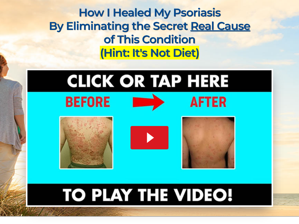PSORIASIS REVOLUTION REVIEW : WHY I ALMOST THREW IT AWAY