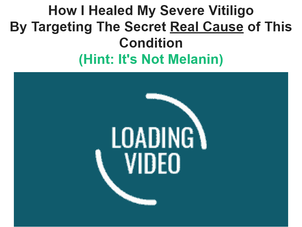 VITILIGO MIRACLE REVIEW – MY 1 MONTH TRANSFORMATION